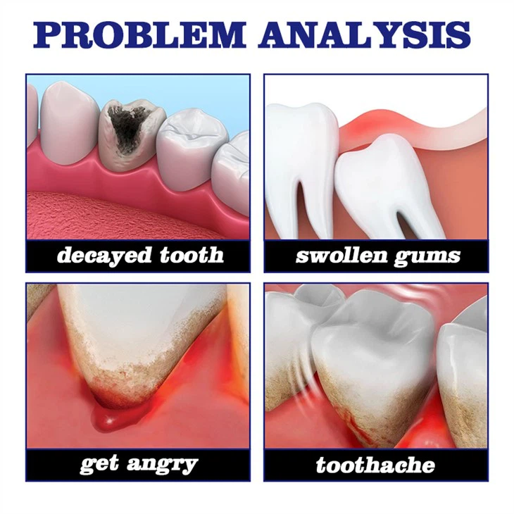 Chinese Herbal Medicine Toothache Spray